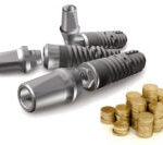 dental-implant-cost