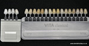 find out the shade needed for your new crowns bridges veneers abroad teeth shading chart