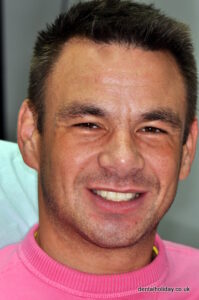 Simon after his dental implants and crowns done