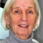 Margaret after her treatement