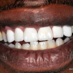 Patient after his treatment