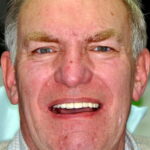John after dental holiday Hohn after dental holiday
