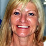 Pamela after her treatment at Dental Holiday