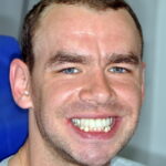 Jack with his new dental crowns